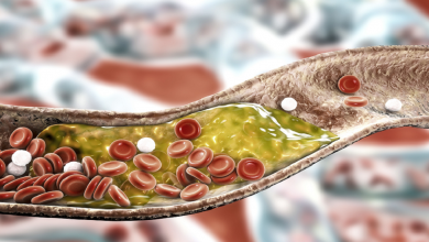 صورة مشروب ساخن يكسر الكوليسترول وقد يخفض مستوياته المرتفعة!